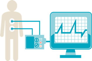 取消“一品雙規(guī)”，國(guó)產(chǎn)高端醫(yī)療器械打破外資壟斷的技術(shù)轉(zhuǎn)讓路徑